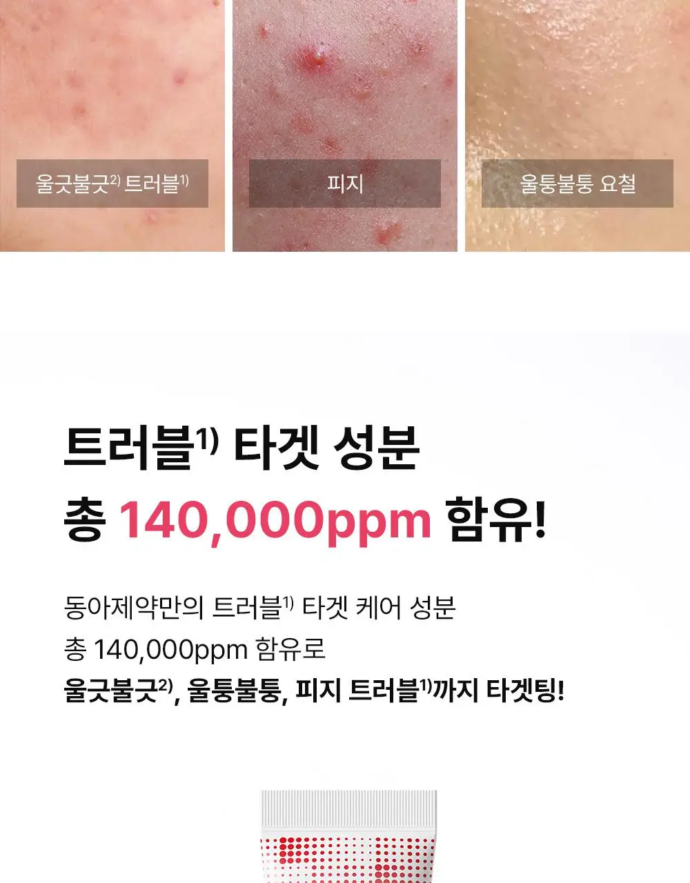 (하루특가)[단독기획] 동아제약 아크네 프로 크림제 30ml 기획(+3ml+겔제3ml) 상세페이지 8